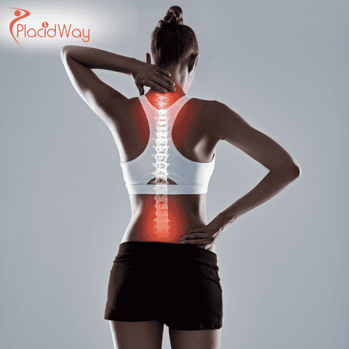 Posterior Fusion Spine Surgery in Turkey: Advanced Solution for UK Patients